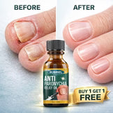 Anti Paronychia Relief Oil - Nail Fungus Oil