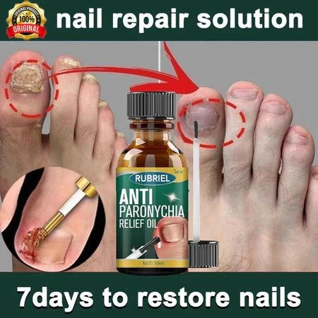 Anti Paronychia Relief Oil - Nail Fungus Oil