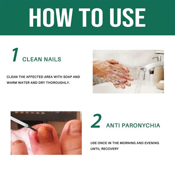 Anti Paronychia Relief Oil - Nail Fungus Oil